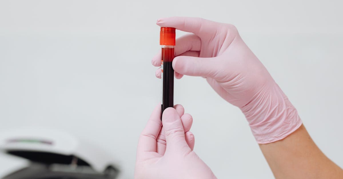 Blutprobenröhrchen neben einem Laborbericht mit Gesundheitswerten